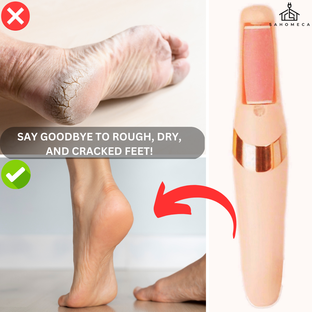 Step into Comfort: Introducing the Deluxe Pedicure™ - Foot Grinder