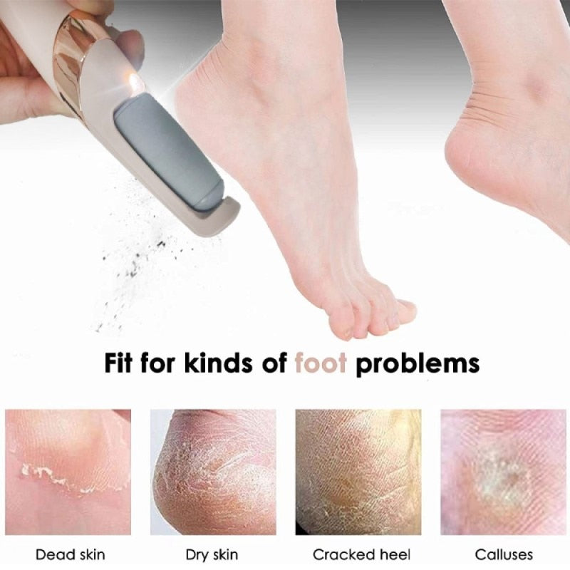 Deluxe pedicure™ - Foot grinder